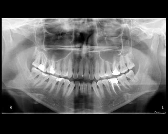 DICOM Printer 1