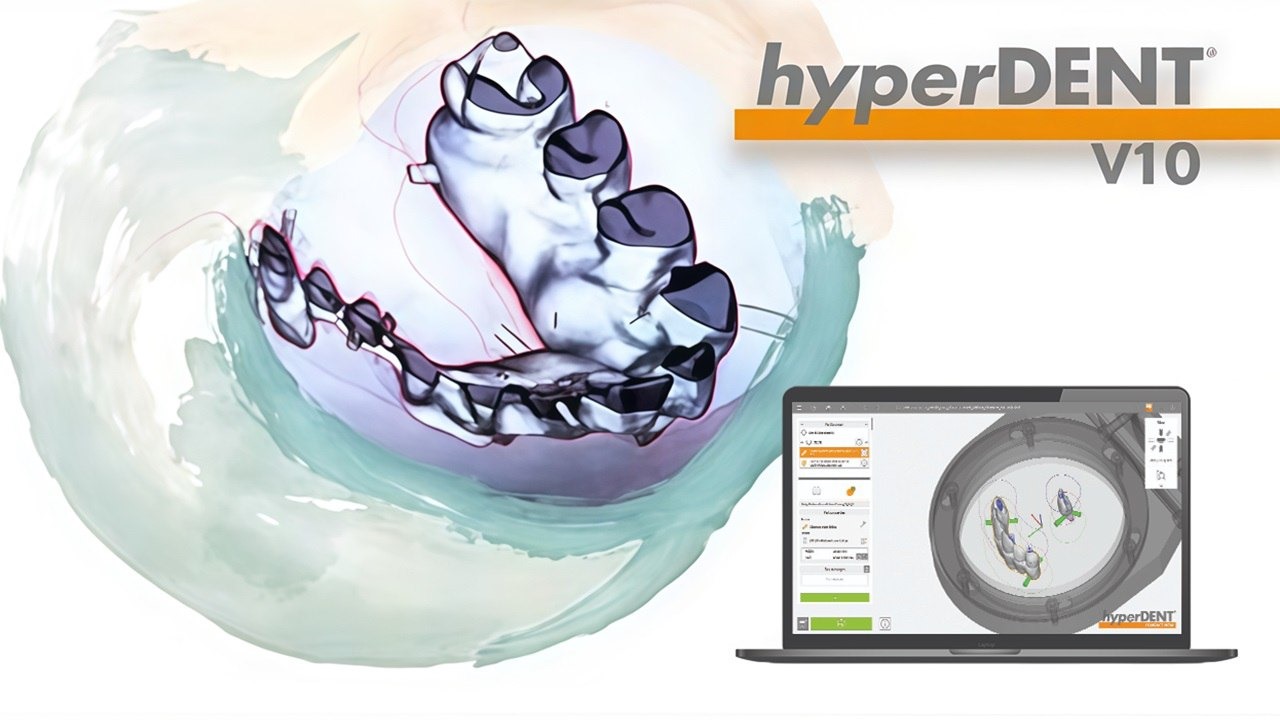 hyperDENT