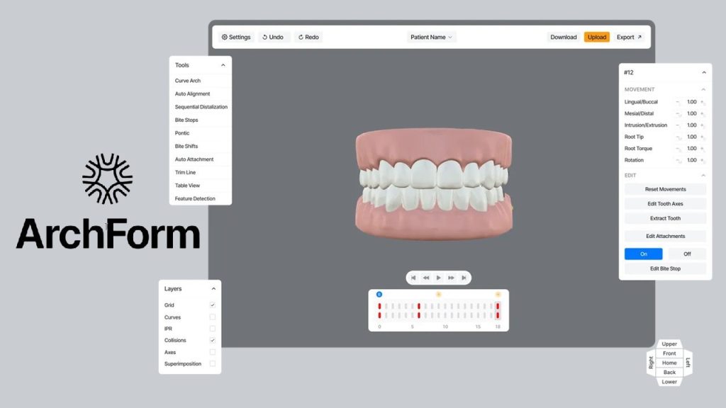 ArchForm 2.6.4.1 (Advanced Orthodontic Platform for Aligners & 3D ...