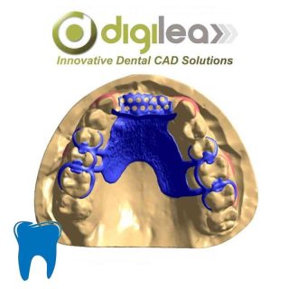 DIGILEA Suite