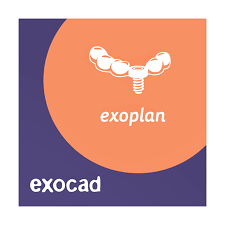 Exoplan