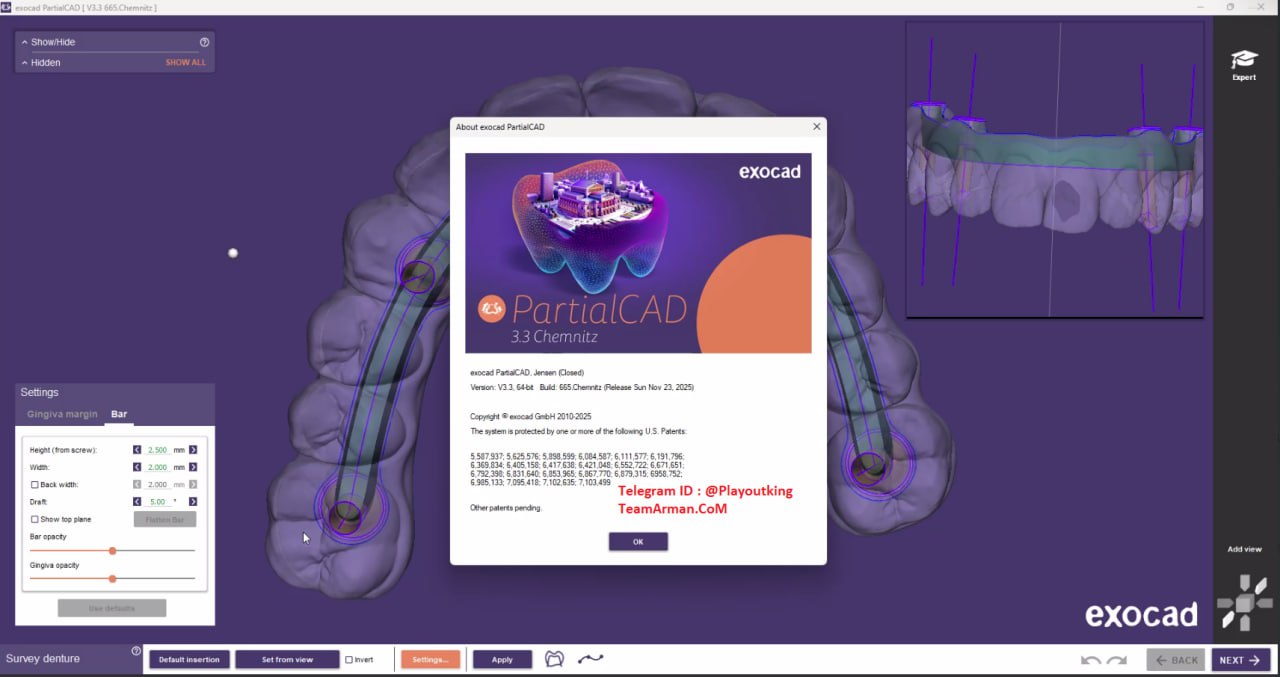 DentalDB + Partialcad